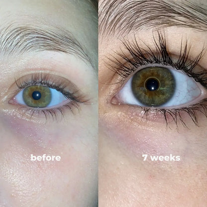 MIREVYN™ Peptide Lash Serum for Fuller, Longer-Looking Lashes