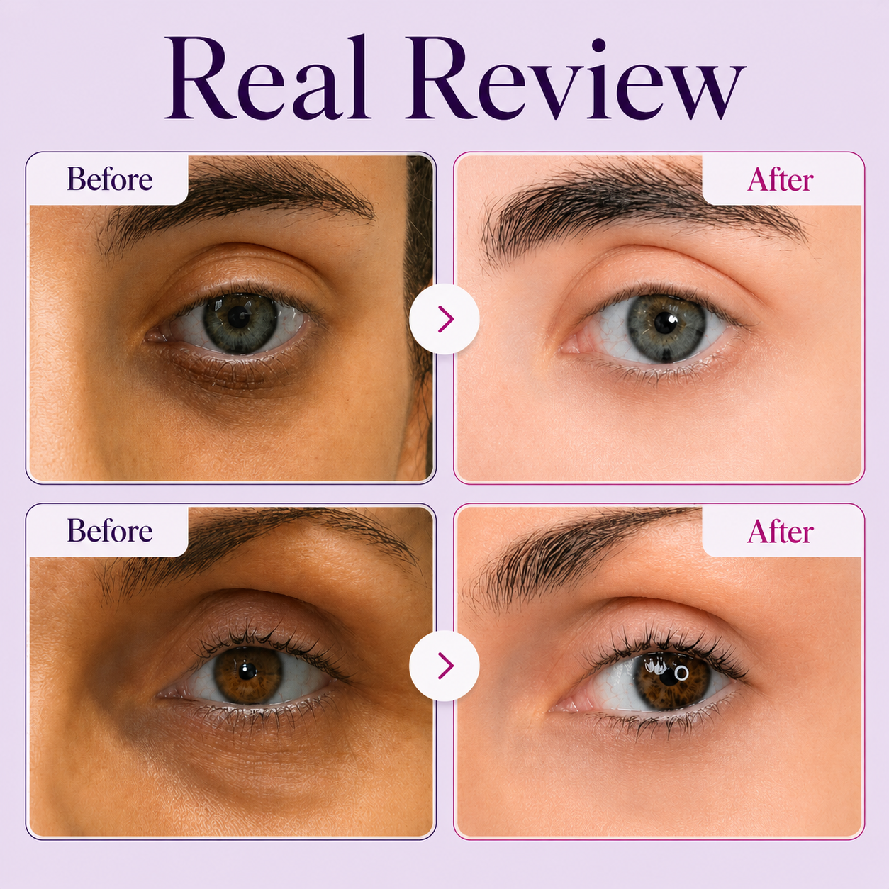 🔥Last Day Buy 1 Get 1 Free Joyivora  Brightening Renewing Eye Cream
