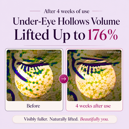 🔥Last Day Buy 1 Get 1 Free Joyivora  Brightening Renewing Eye Cream