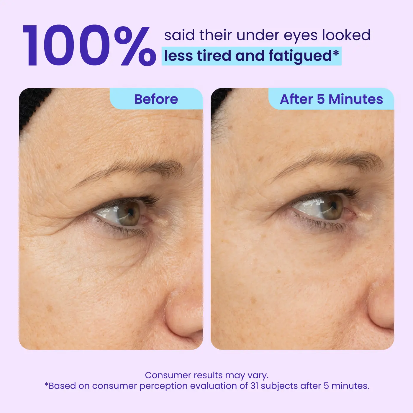 49% OFF · Limited-Time Deal ✨Joyivora Instant Lift Eye Gel
