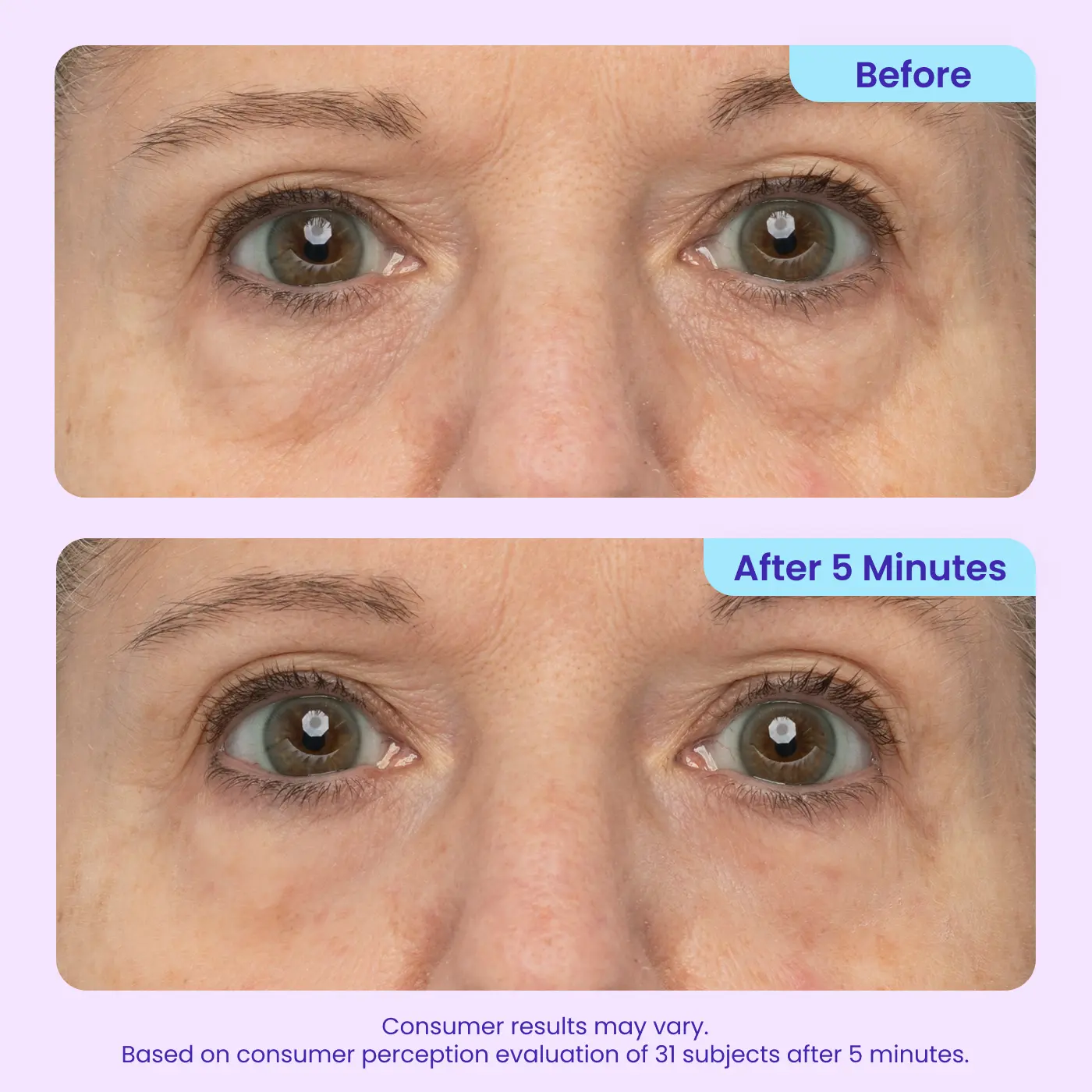49% OFF · Limited-Time Deal ✨Joyivora Instant Lift Eye Gel