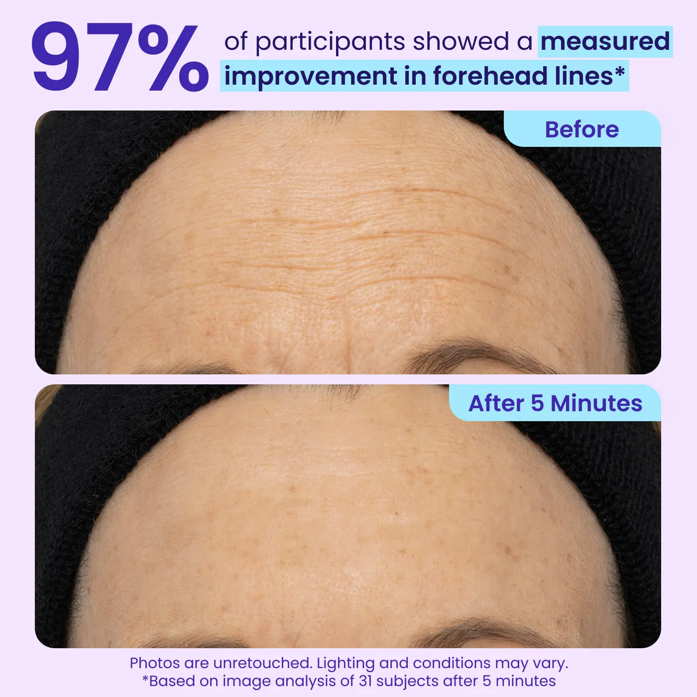 49% OFF · Limited-Time Deal ✨Joyivora Instant Lift Eye Gel