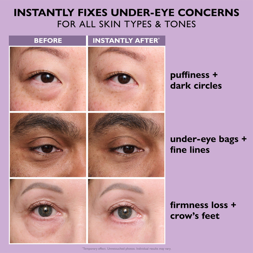 49% OFF · Limited-Time Deal ✨Joyivora Instant Lift Eye Gel